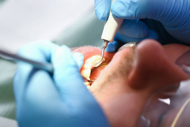 Best Broken or Cracked Tooth Emergency Dentist in Fairfax Station, VA